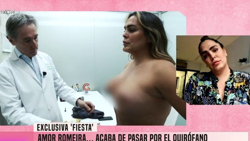 Amor Romeira se somete a una reducción de pecho y muestra el resultado: "Tengo ganas de enseñároslas" Fiesta 2025 Top Vídeos 555