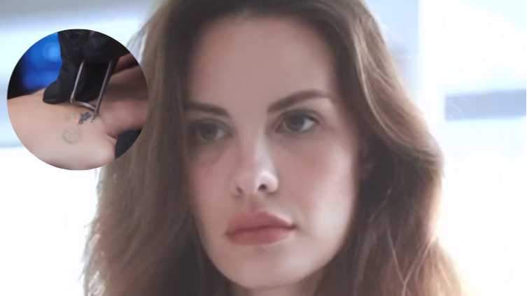 Jessica Bueno se elimina el tatuaje que se hizo por Jota Peleteiro