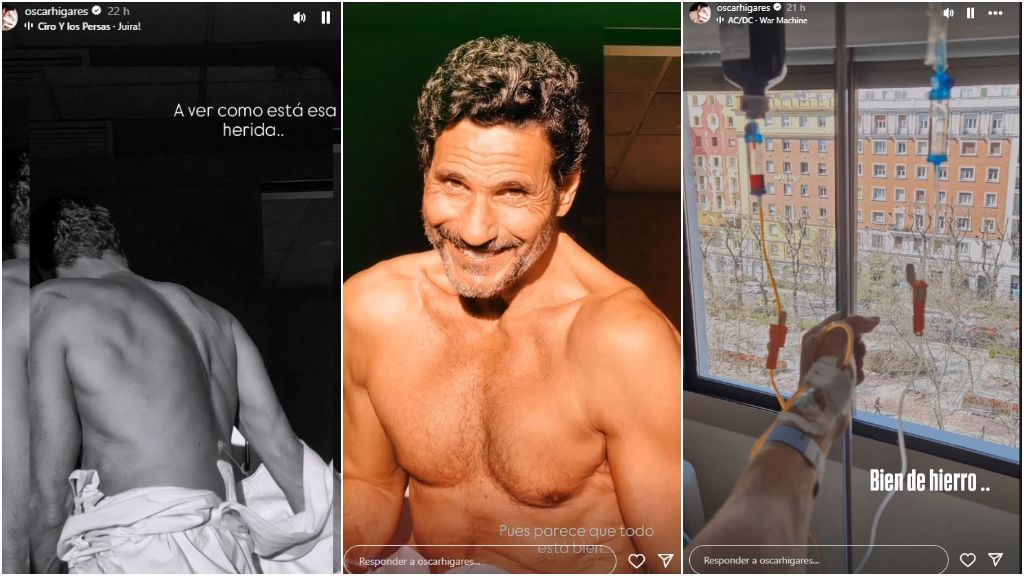 Óscar Higares bromeando sobre su operación