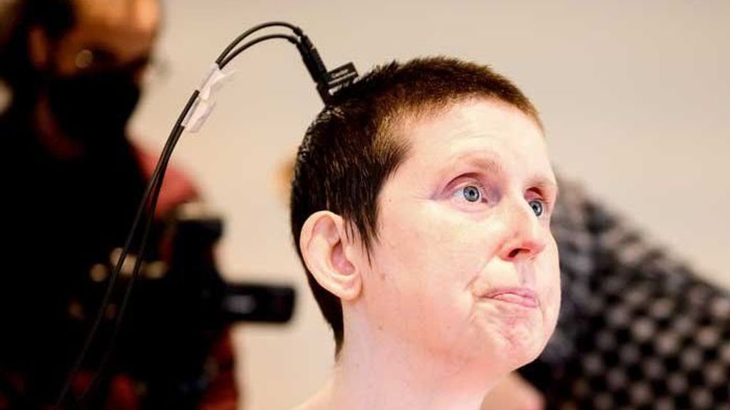 Ann, la mujer que ha podido volver a hablar tras estar sin hacerlo 20 años gracias a un dispositivo con IA