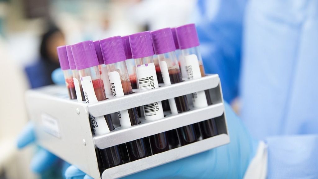 El análisis de sangre que diagnostica el Alzheimer: tienen un 92% de precisión