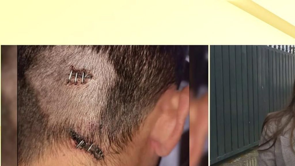 Dispara a su inquilino en la cabeza por dos meses de alquiler: "El disparo fue por la espalda y a traición"