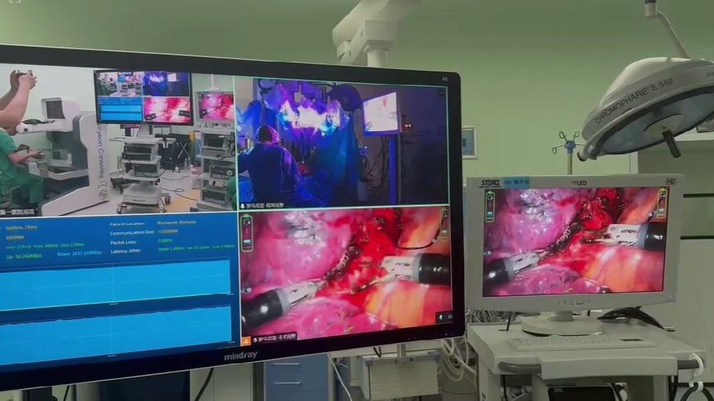 El cirujano gallego Diego Gonzalez Rivas realiza primera operación de cáncer de pulmón trasoceánica