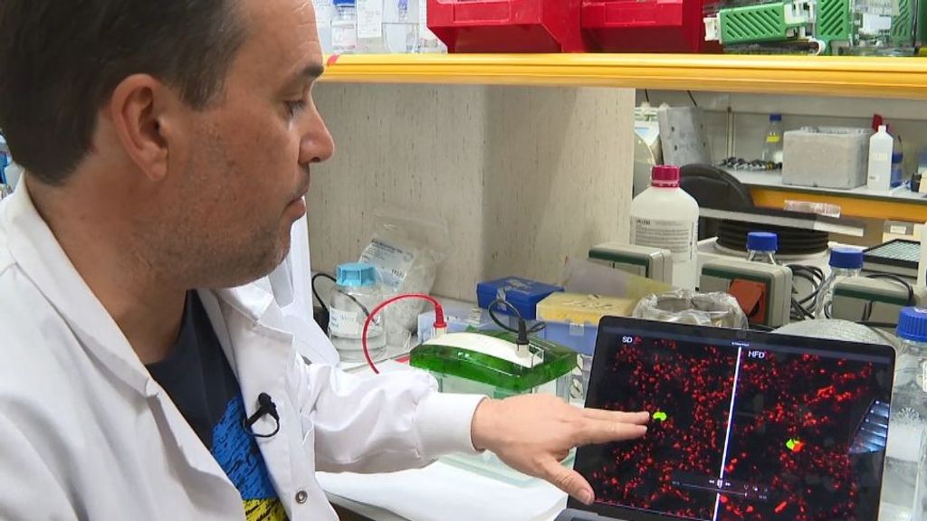 Un estudio revela que las dietas grasas favorecen el riesgo de metástasis en el cáncer de mama