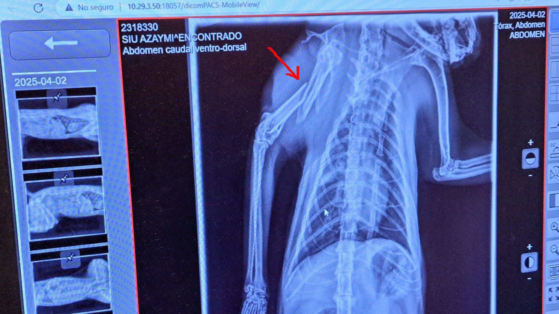 Imagen de la radiografía realizada a la gata herida