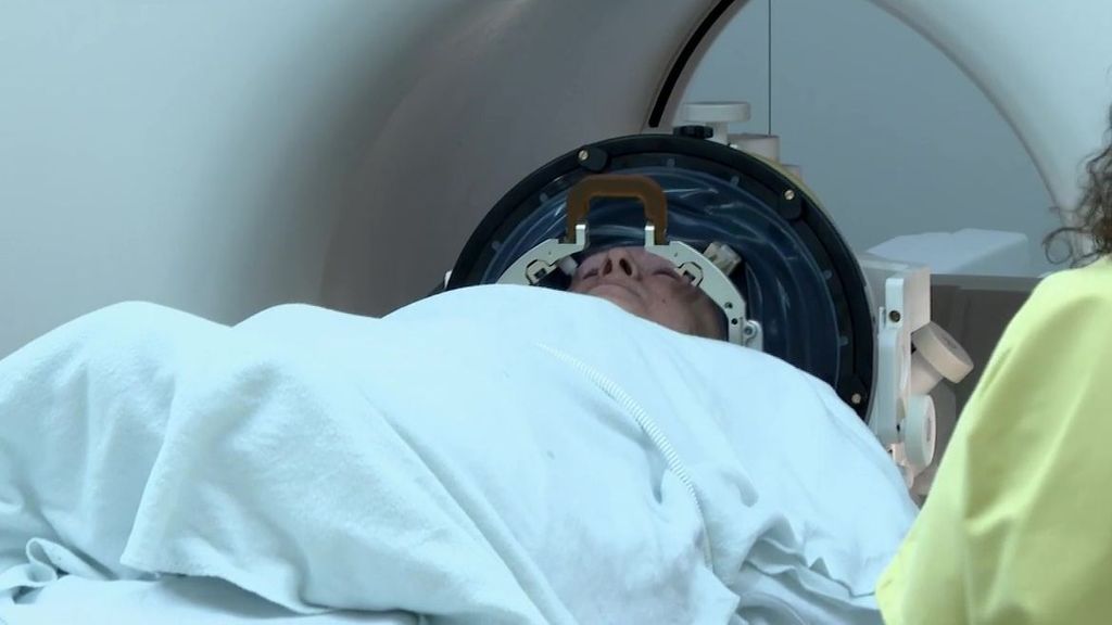 Así funcionan los ultrasonidos para revertir los temblores esenciales
