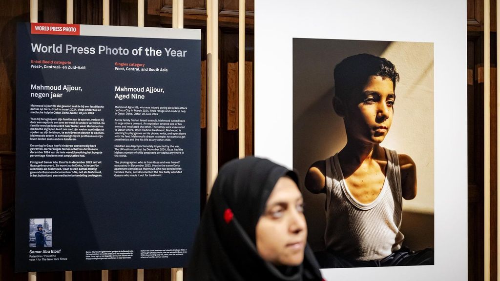 Un niño amputado de los dos brazos, imagen del World Press Photo: los ataques israelíes continúan en Gaza