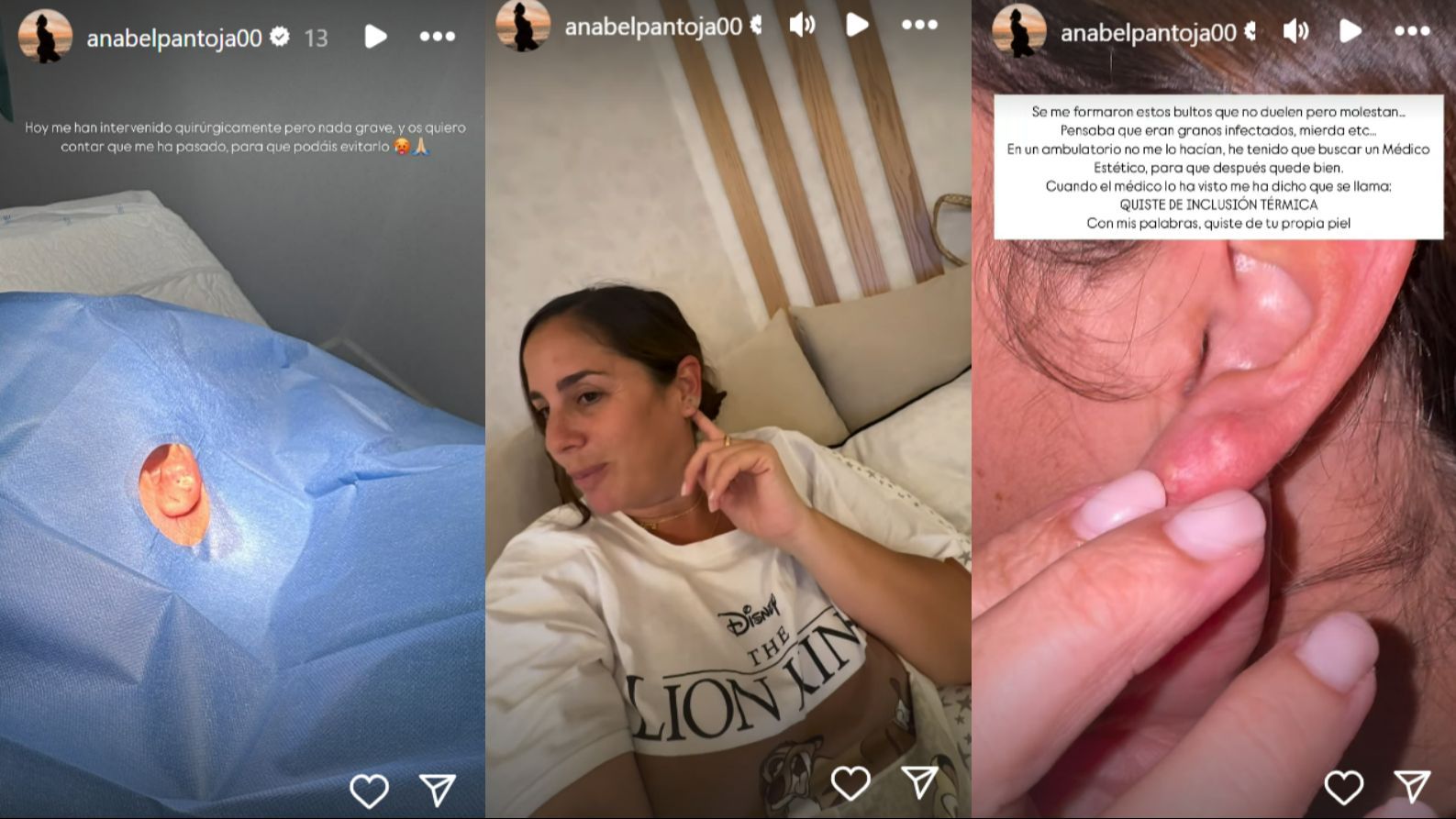 Anabel Pantoja explica que la han intervenido quirúrgicamente