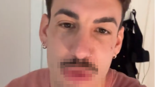 Luitingo se retoca los labios y enseña el resultado