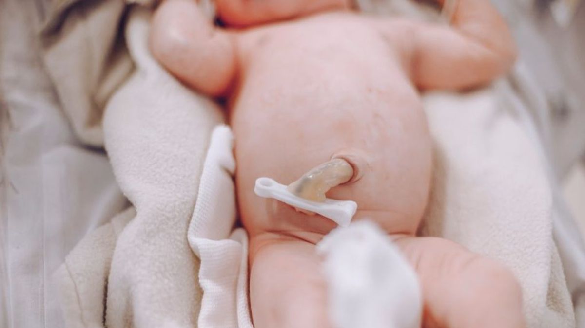 Un bebé con el cordón umbilical