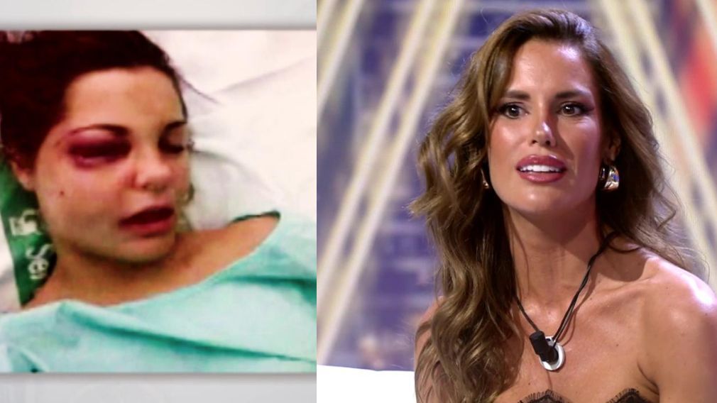 El antes y el después de Gala