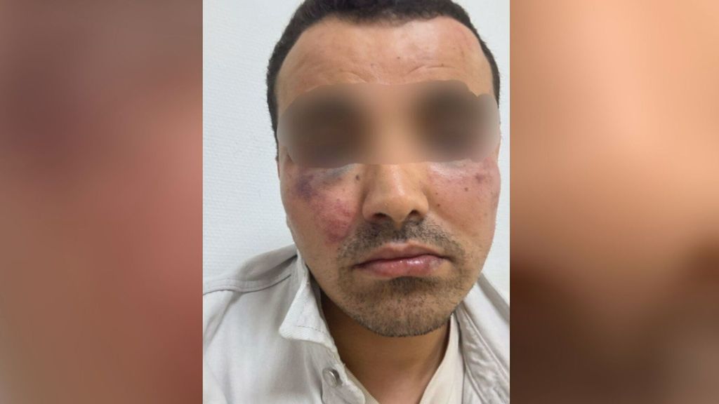 El taxista de Barcelona agredido en Benidorm por parte de varios compañeros valencianos