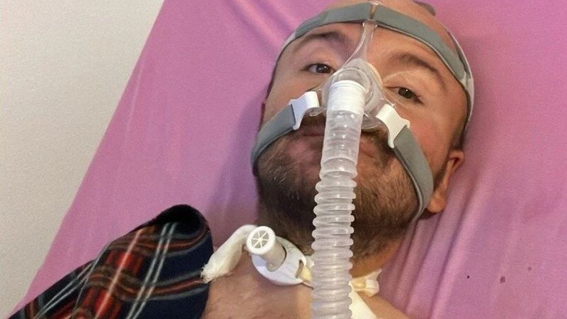 Álvaro González, conectado a un respirador