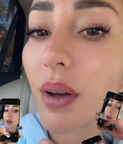 Aurah Ruíz sin rellenos de labios