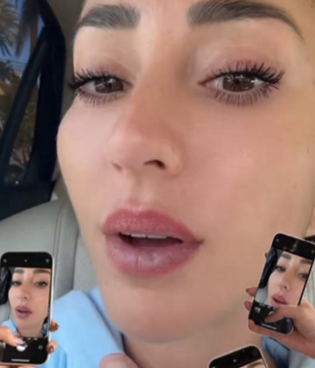 Aurah Ruíz sin rellenos de labios