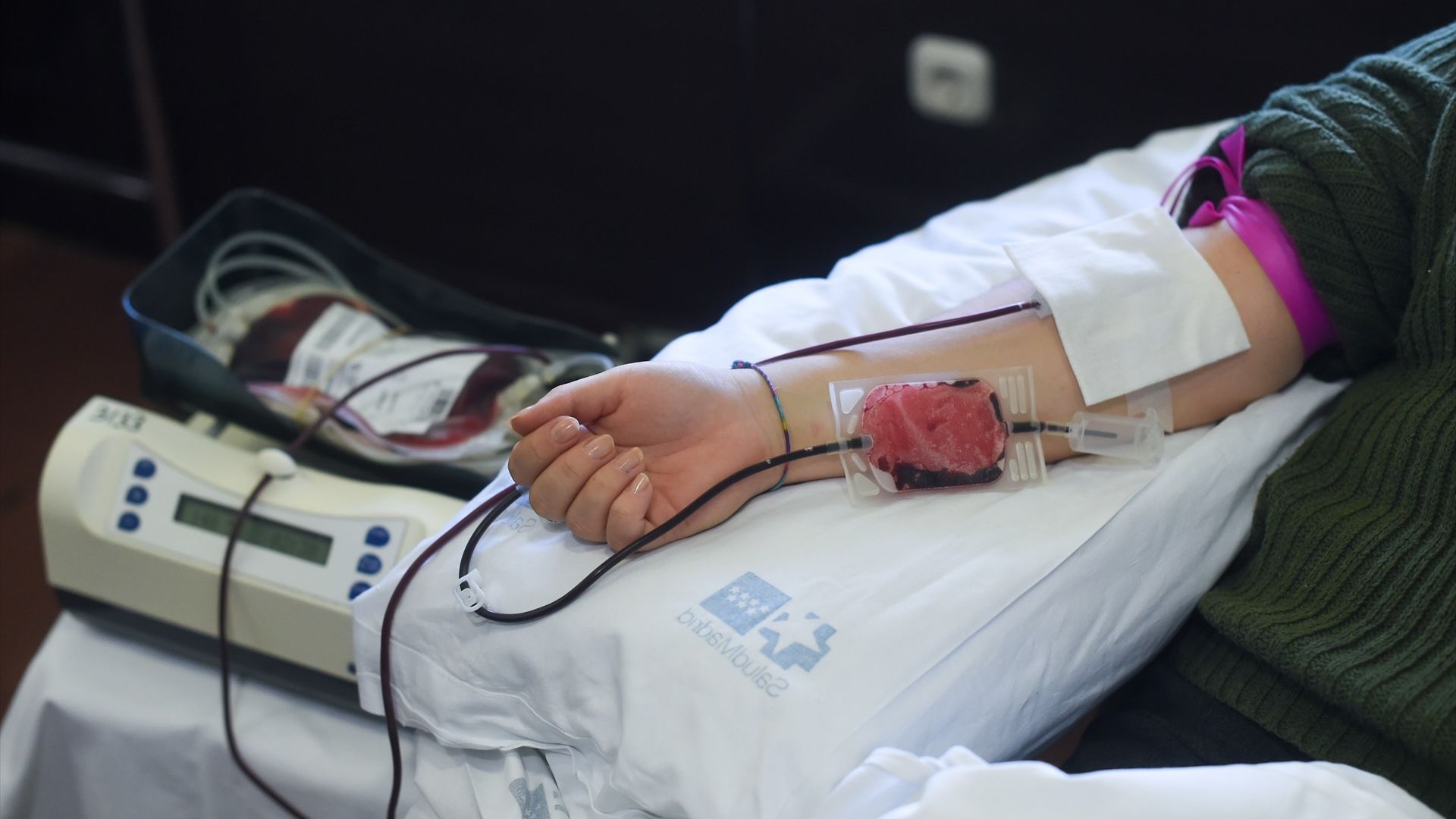 Los pacientes con talasemia severa deben someterse a transfusiones de sangre muy frecuentemente. Foto de archivo de una persona donando sangre