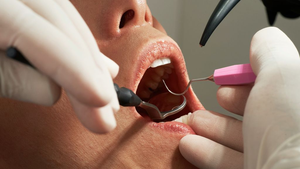 dientes unsplash