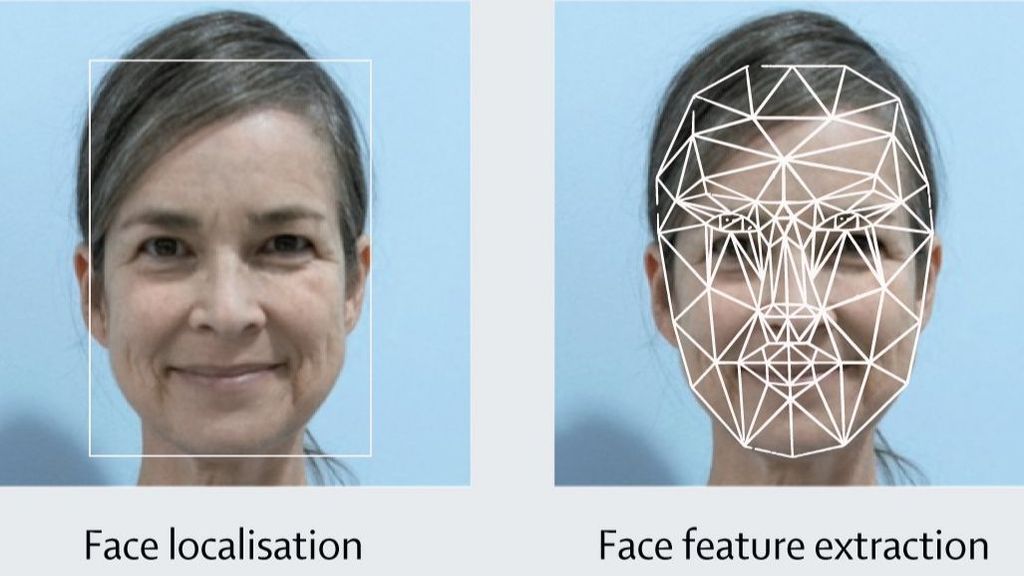 El análisis realizado por FaceAge