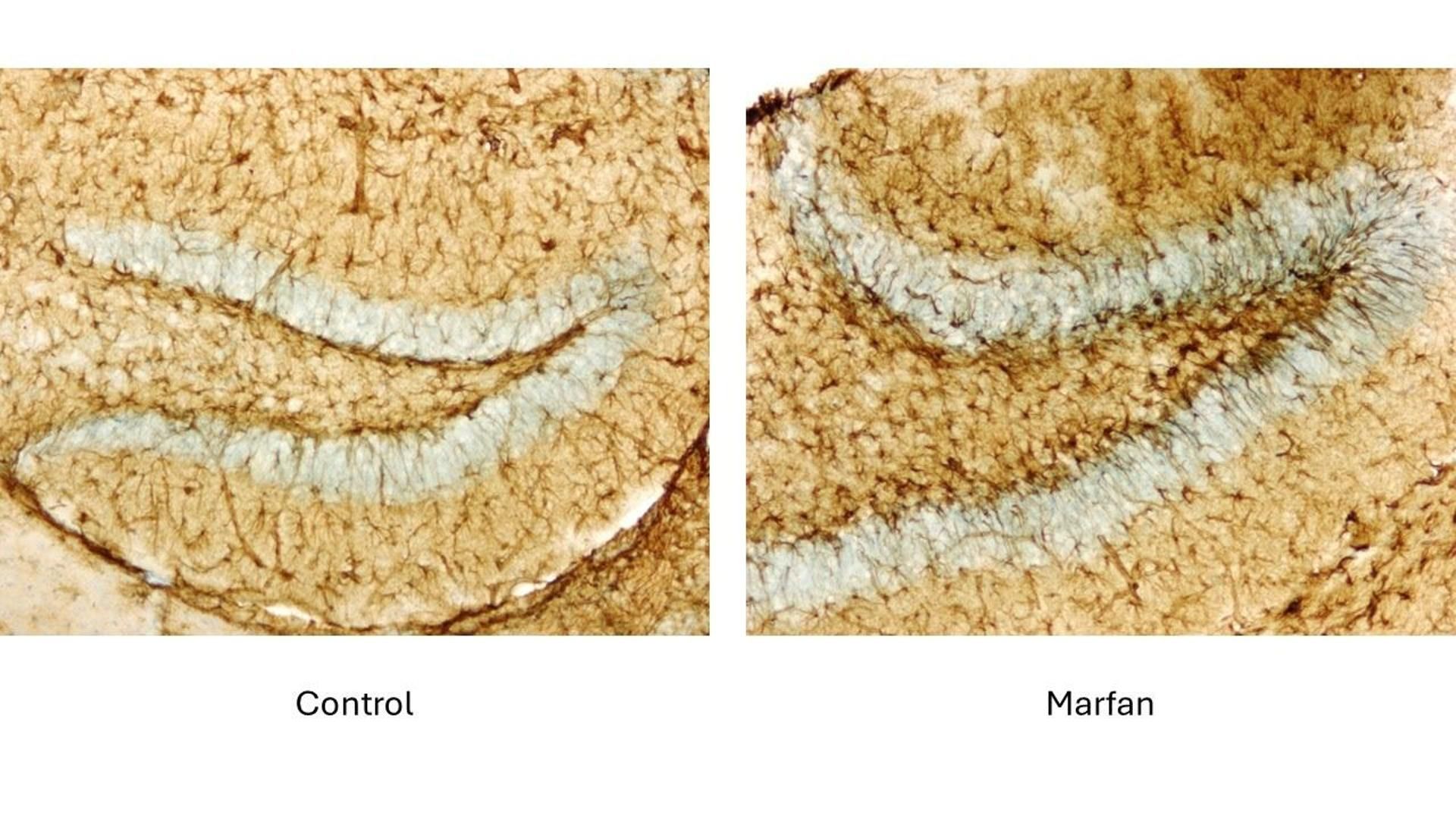 Astrócitos en el hipocampo de ratones machos