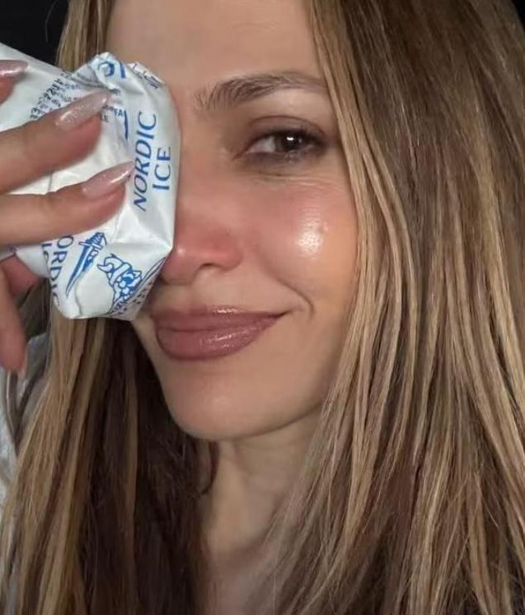 Jennifer Lopez se rompe la nariz tras sufrir una aparatosa caída