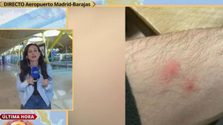 Preocupación ante una plaga de chinches en el aeropuerto de Madrid: "Es ...