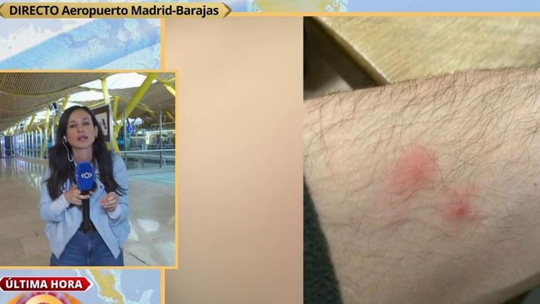 Preocupación ante una plaga de chinches en el aeropuerto de Madrid: "Es ...