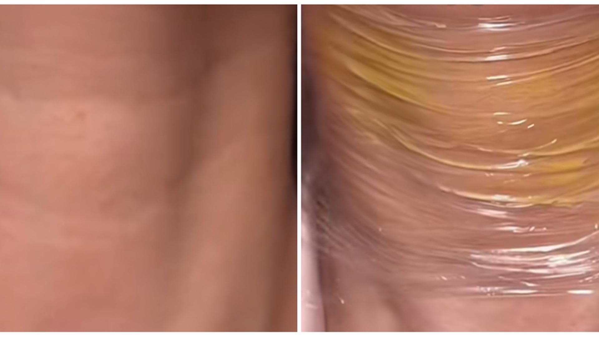El truco viral de aplicar retinal en el cuello para acabar con las arrugas El truco viral de aplicar retinal en el cuello para acabar con las arrugas