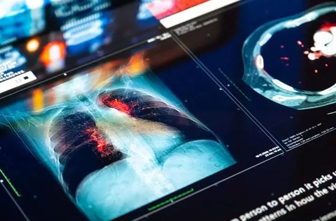 Oncólogos de referencia forman a investigadores en cáncer de pulmón