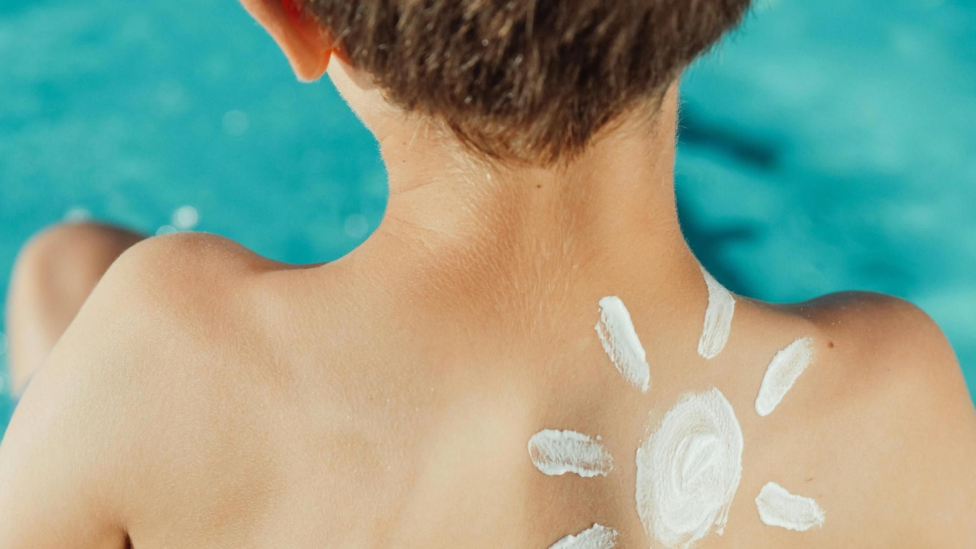 Un niño con crema solar en la espalda