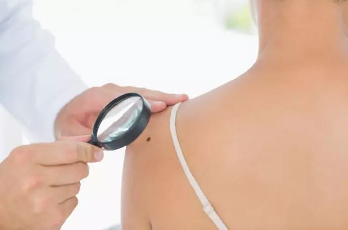 Un virus común podría mejorar "significativamente" la respuesta de pacientes con melanoma