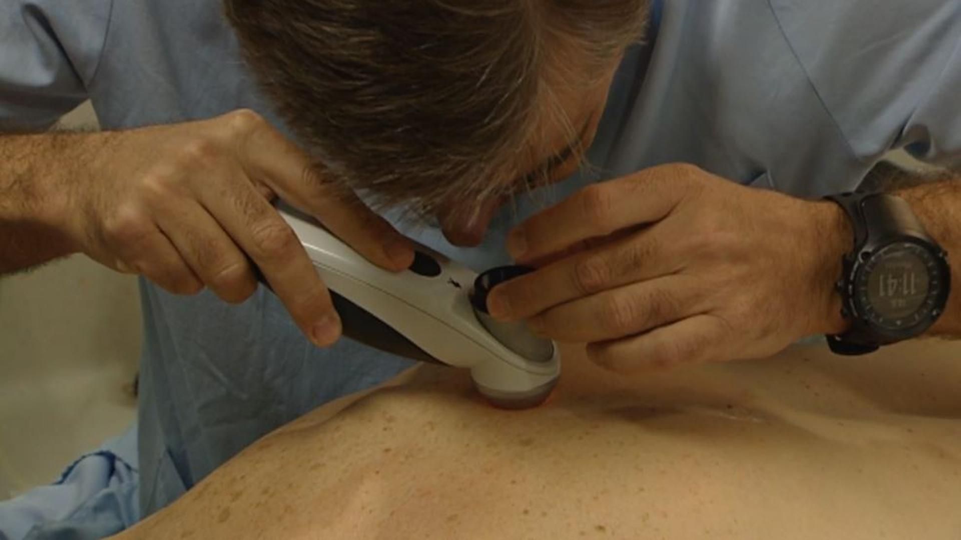 Día Mundial del Melanoma: culpable de 1.000 muertes al año, se detectarán 9.400 casos en 2025