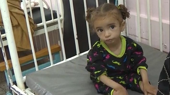 Mayar, una de las niñas que sufre la preocupante desnutrición en Gaza: "Tiene dos años, es celiaca y sufre diarrea crónica"