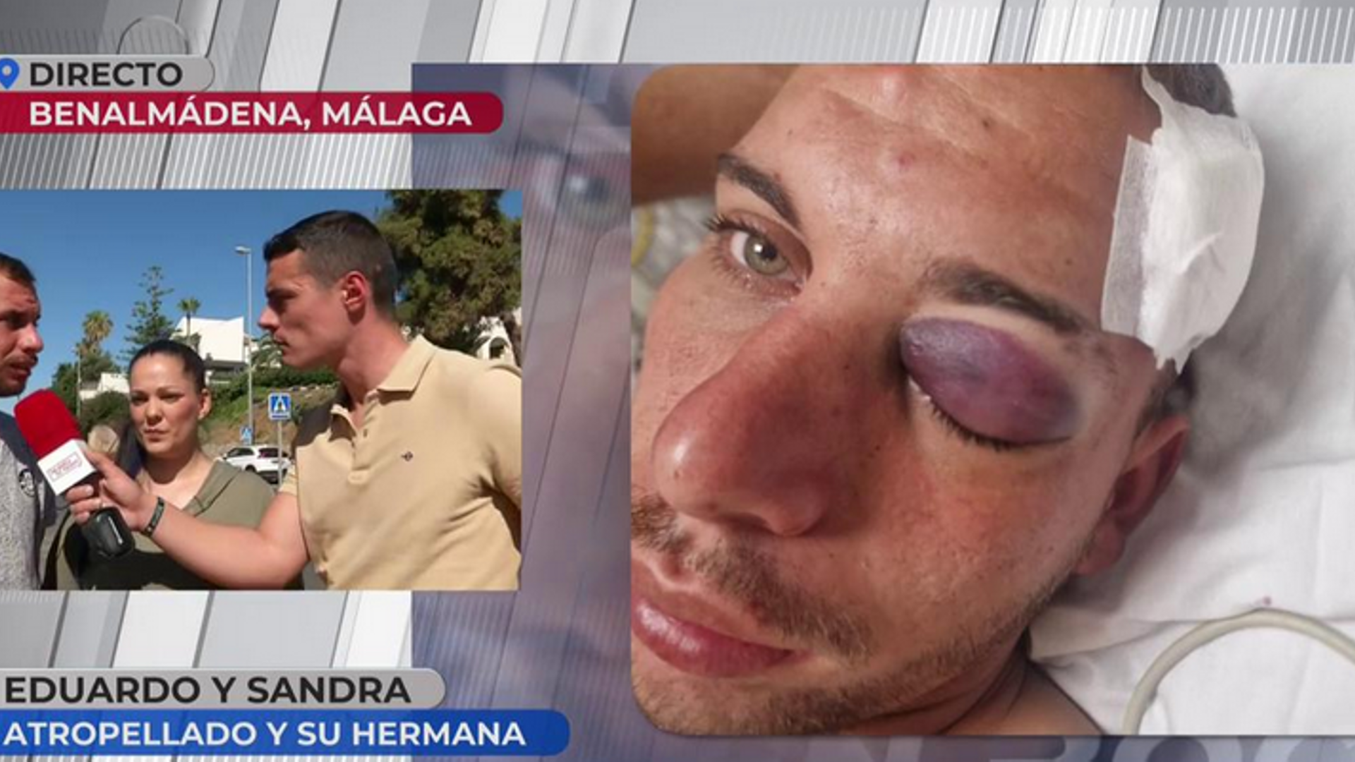 Eduardo gravemente herido en el hospital
