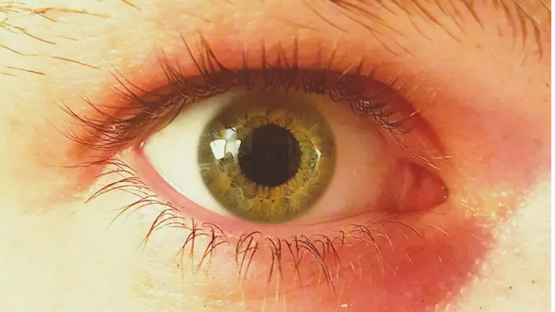 Retinoblastoma infantil: el cáncer ocular que avisa con un destello blanco en los ojos si haces una foto