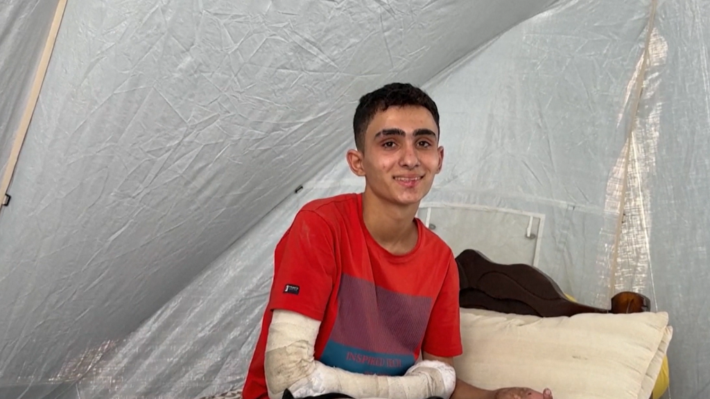 Ahmed Al-Ghalban, el joven acróbata que perdió sus dos piernas y a parte de su familia en un ataque israelí