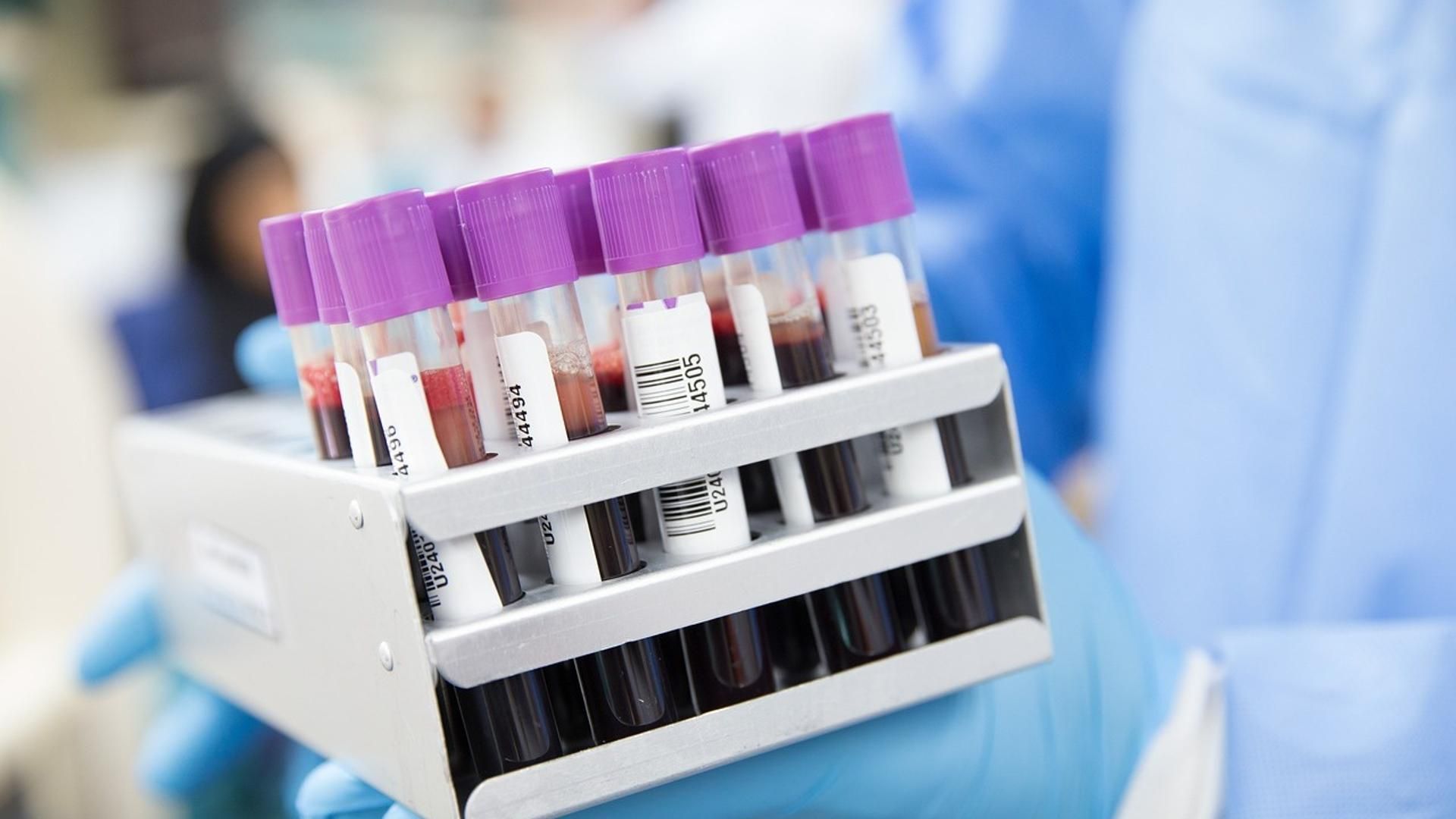 Imagen de recurso de tubos con sangre para su análisis Imagen de recurso de tubos con sangre para su análisis