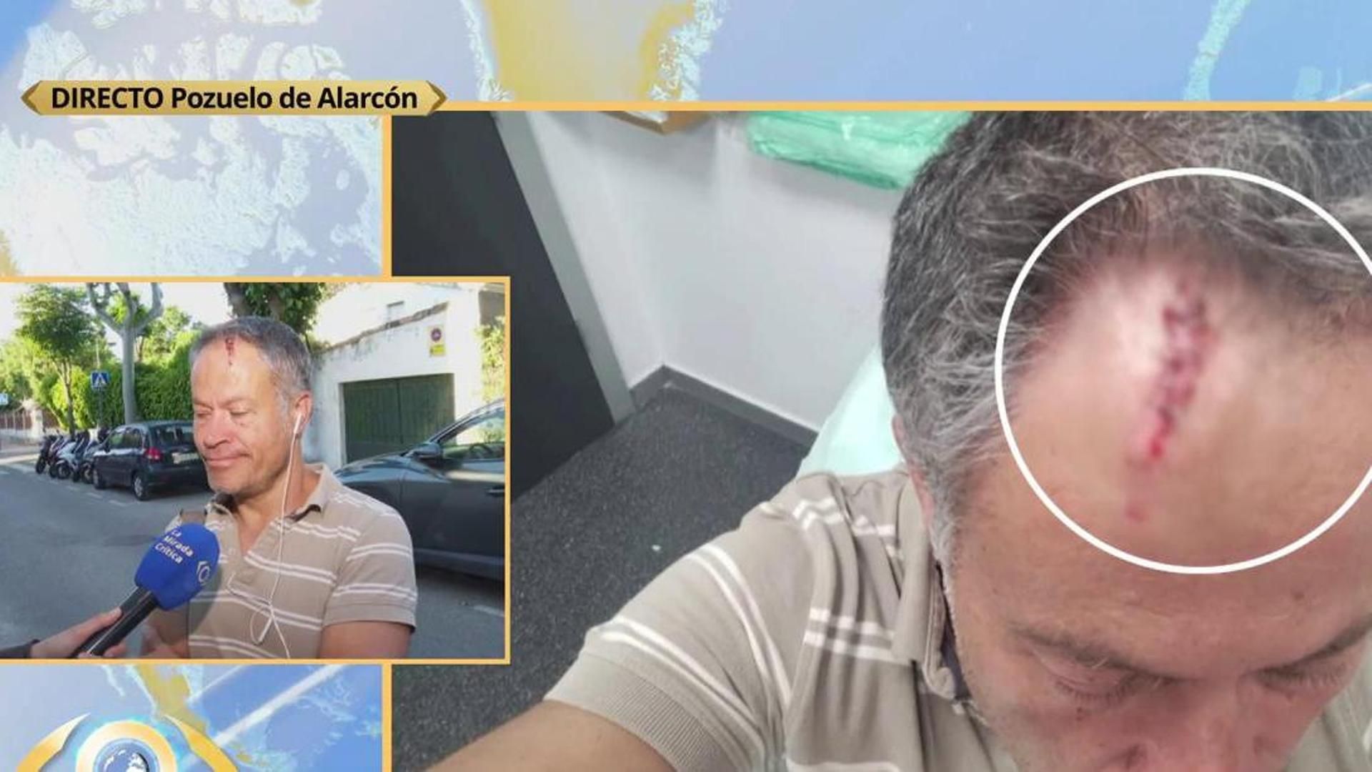 Okupas agresivos la emprenden a pedradas con su vecino: "No me han matado de milagro"