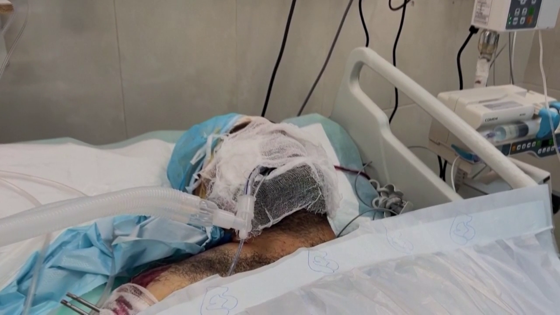 Hamdi Yahya Najjar, padre de los nueve niños fallecidos en un bombardeo israelí en Jan Yunis, ha muerto