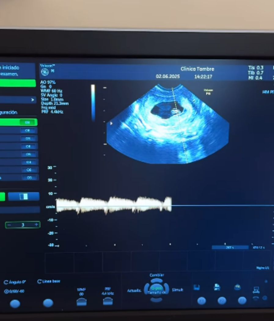 Marta Peñate vuelve a escuchar el latido de su bebé