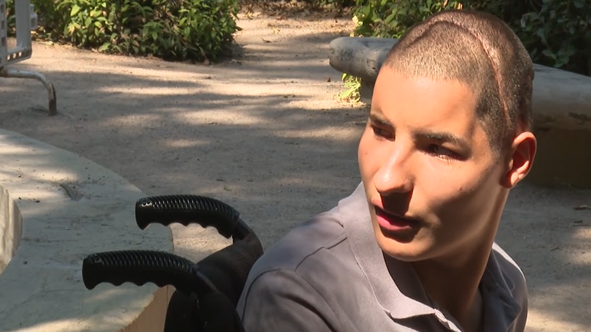Roque, un joven parálisis cerebral y 50 operaciones a sus espaldas: "Tengo un 131 de coeficiente intelectual”