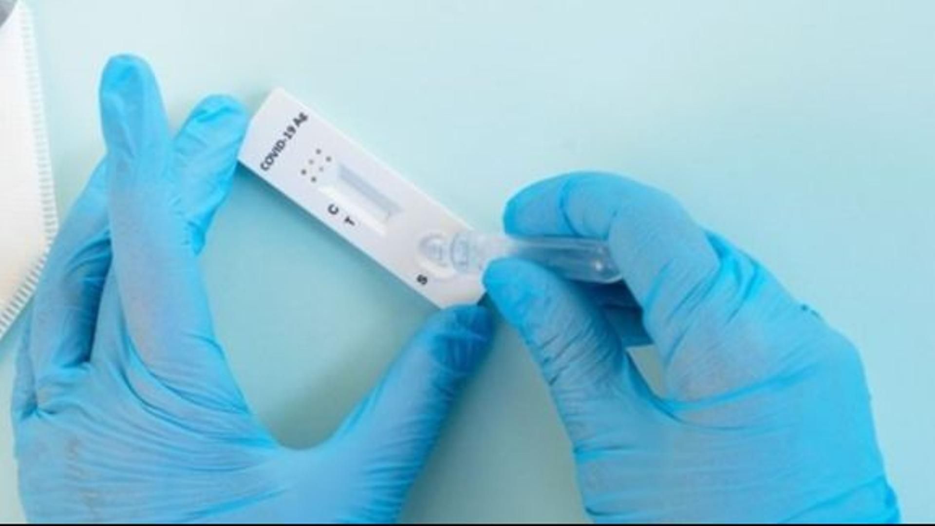 Test de antígenos para Covid-19.
