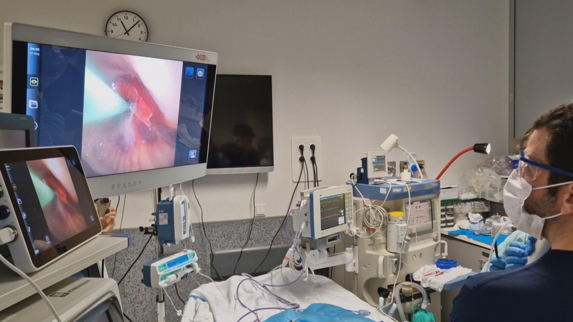 Técnica pionera contra el cáncer de pulmón aplicada en el HUCA