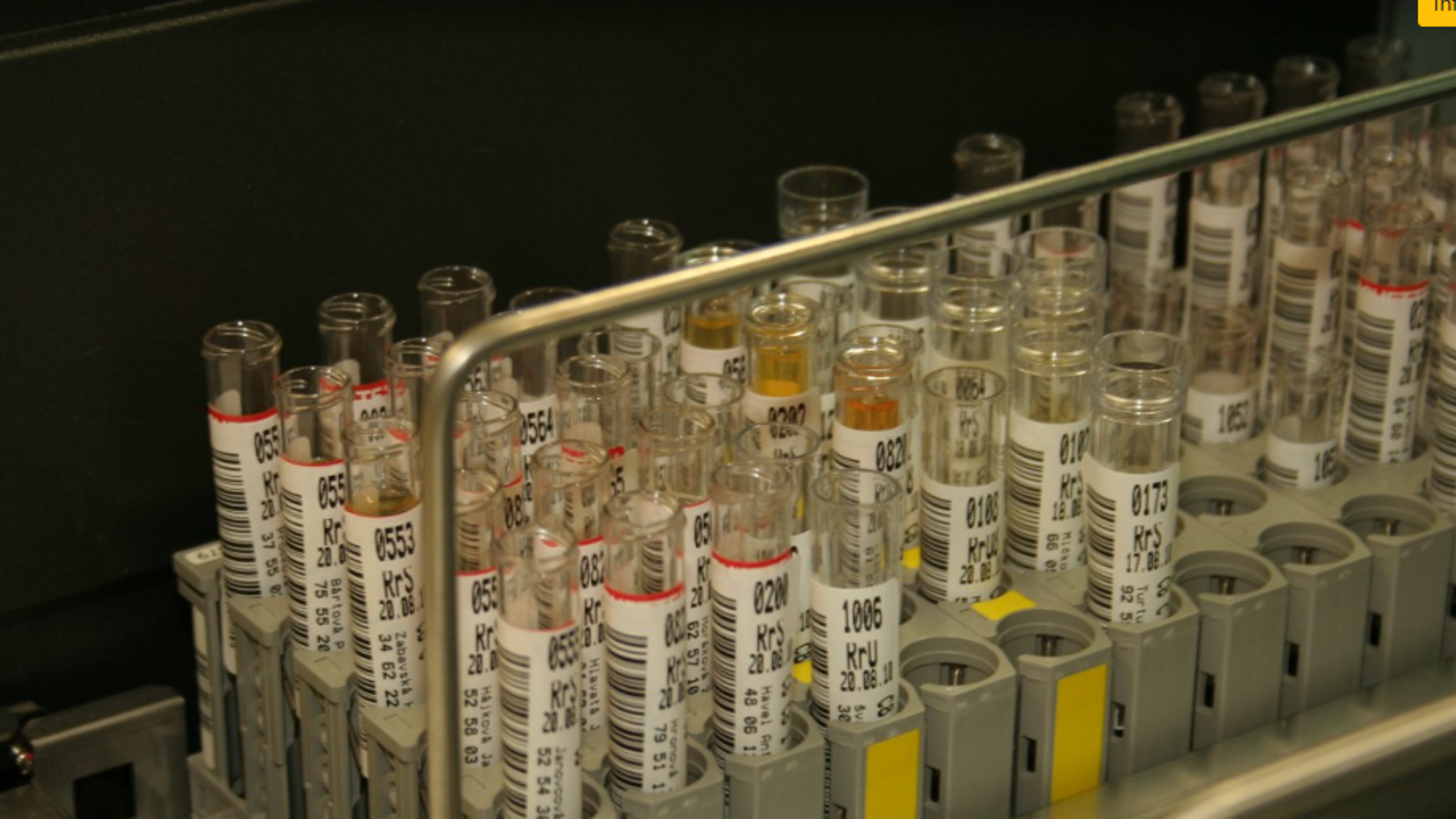 El primer test que permite identificar el cáncer de próstata en casa: resultados fiables en 15 minutos