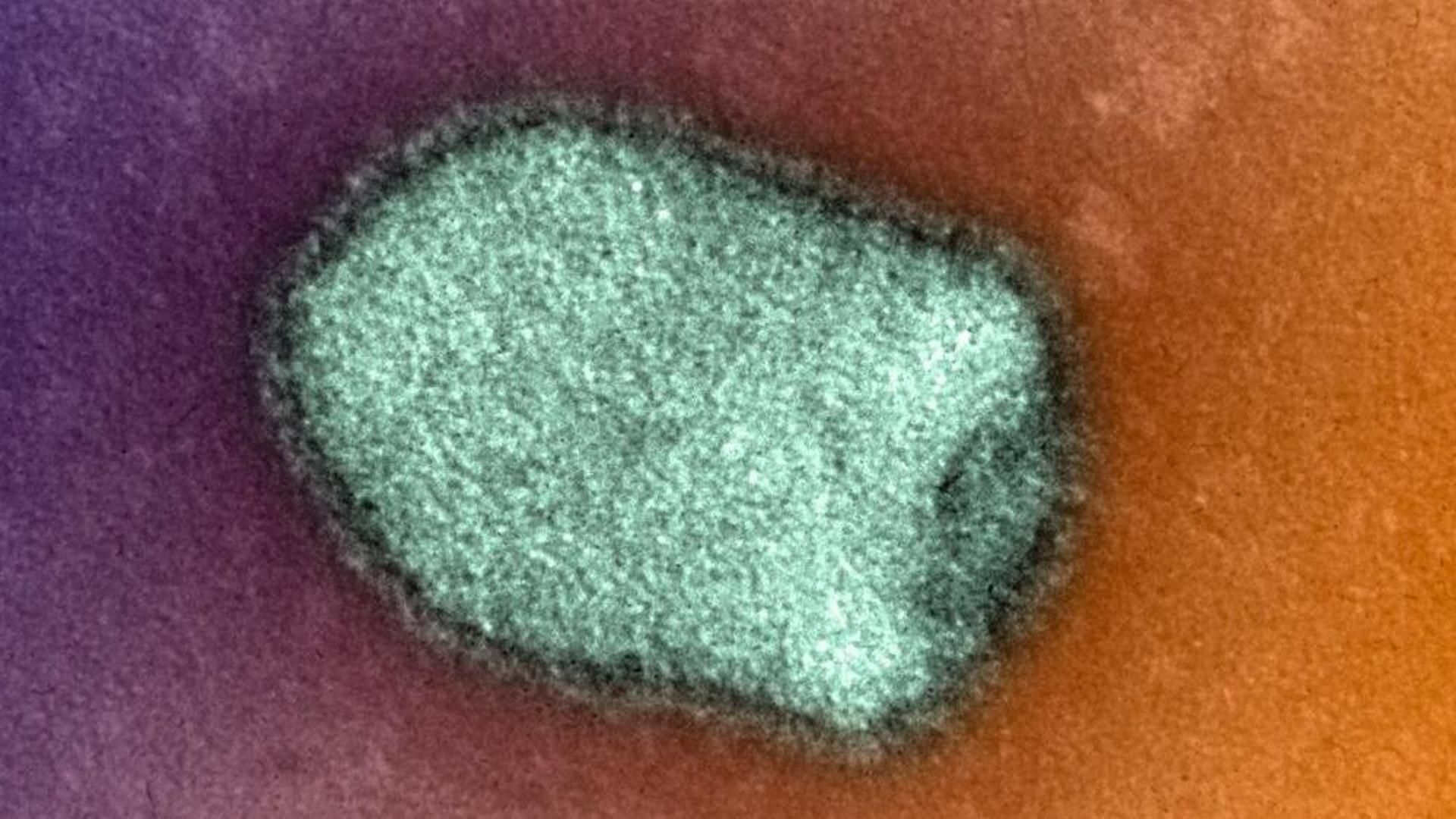 Un español de 44 años, aislado por rabia en la UCI de un hospital de la Comunidad Valenciana tras un mordisco canino en África