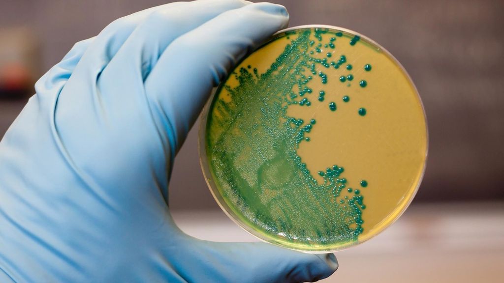 Archivo - Imagen de recuros de 'Listeria'.