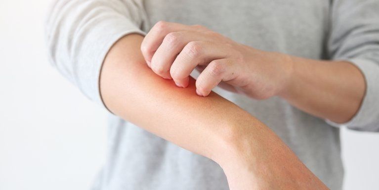 Persona rascándose el brazo por dermatitis