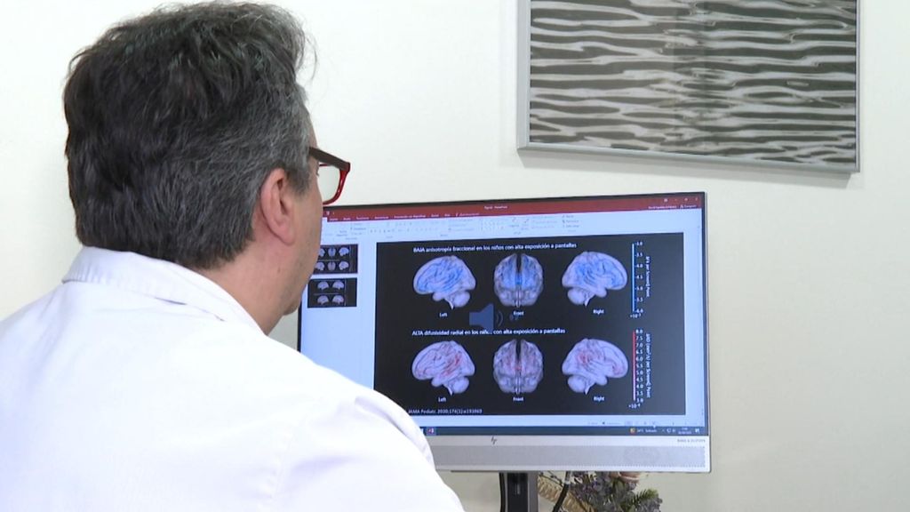 El exceso de pantallas en niños de 3 a 5 años, un peligro para el desarrollo de su cerebro
