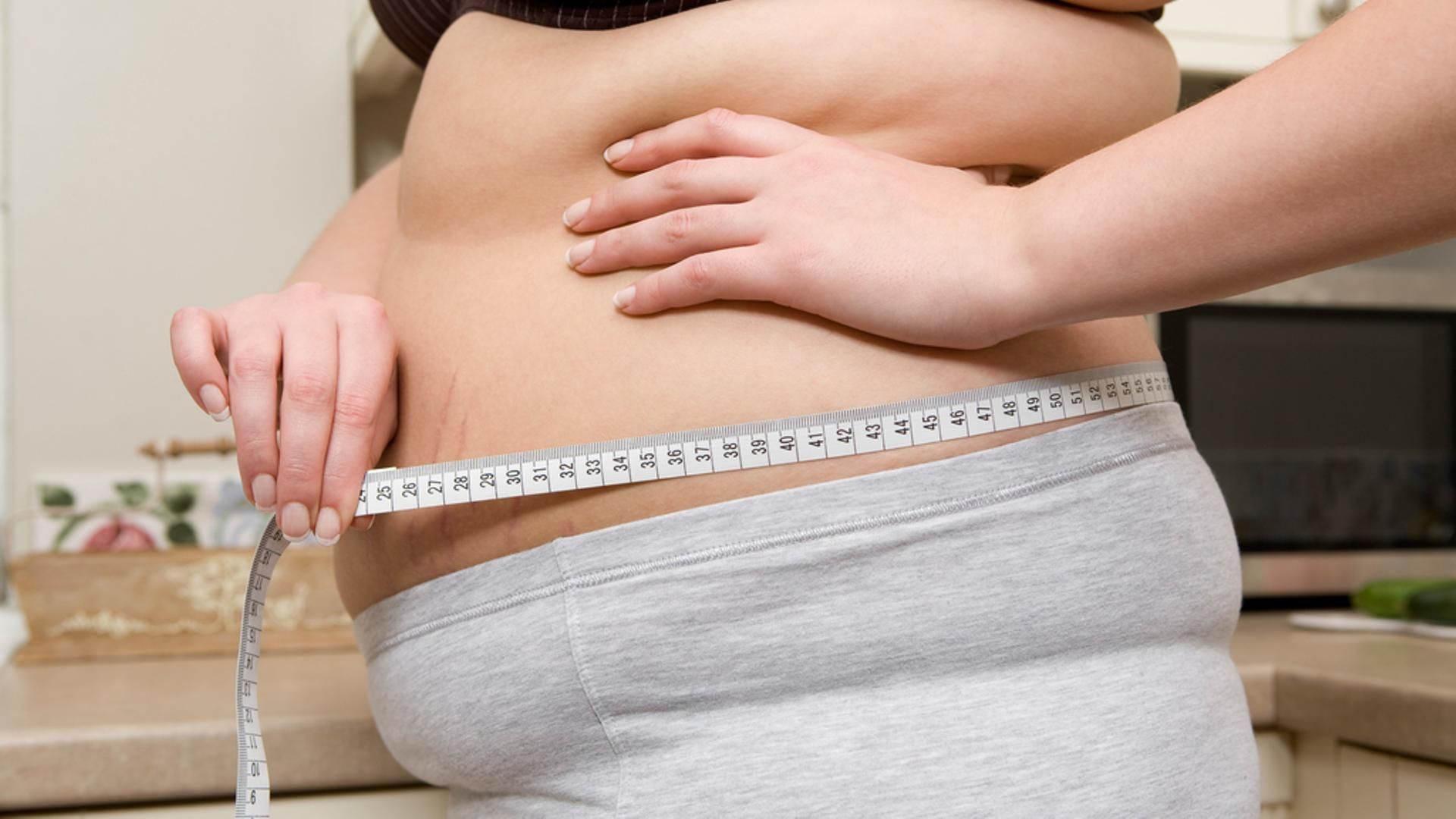 obesidad, sobrepeso,