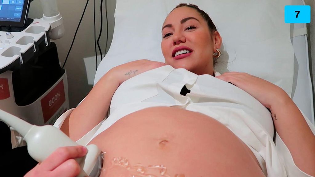 Steisy se somete a una ecografía 5D y ve la cara de su bebé al detalle (1/2)