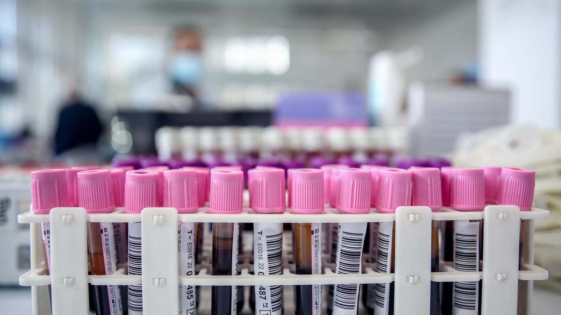Tubos de sangre en un laboratorio del Centro de Transfusión Tubos de sangre en un laboratorio del Centro de Transfusión